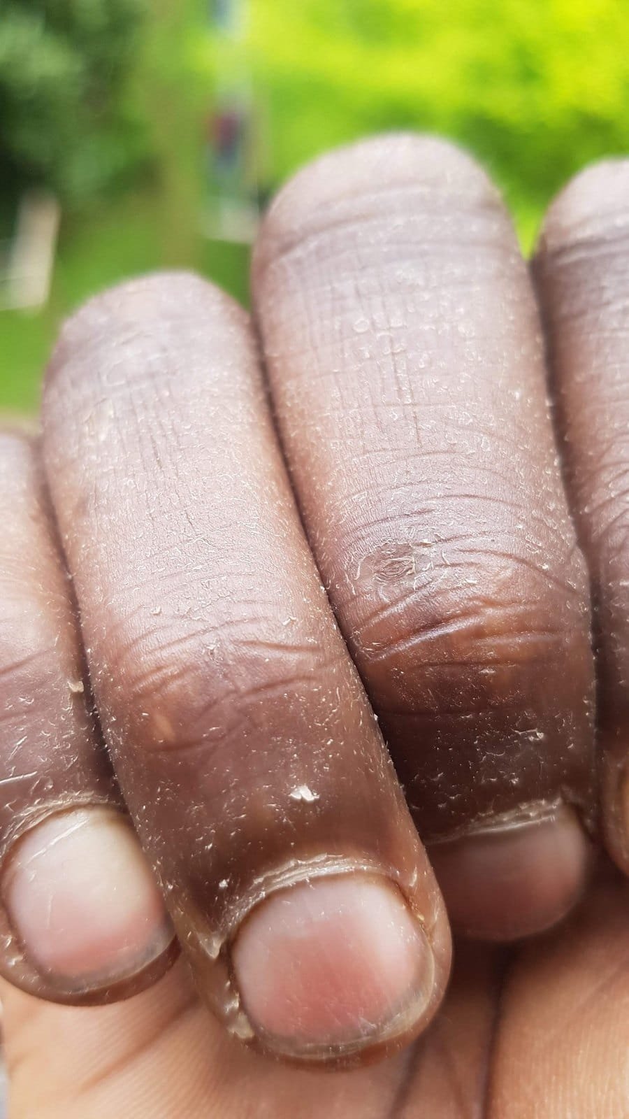 My hands, Monday 22 April 2019, 12:22