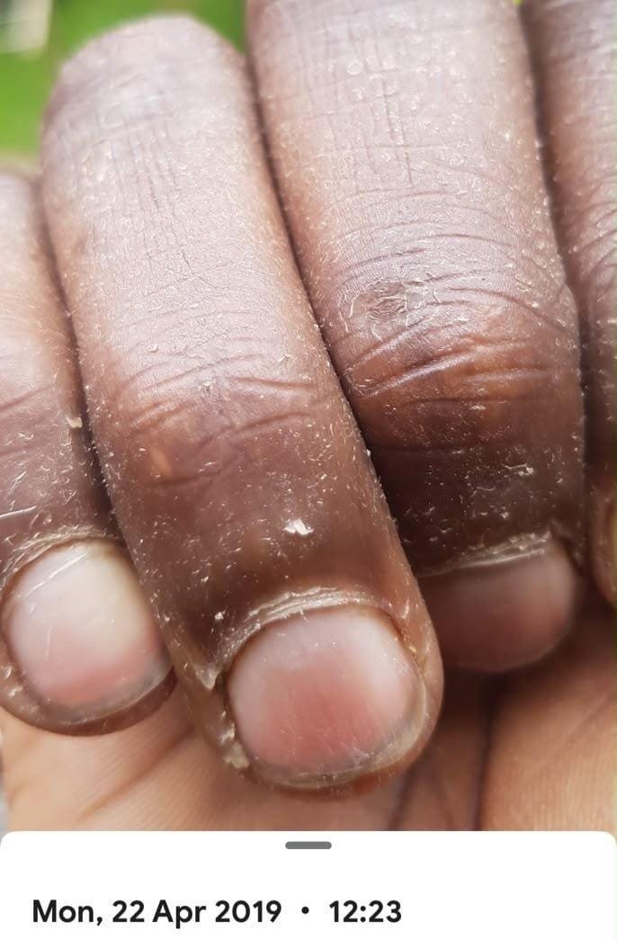 My hands a minute later, with the date on the phone